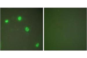 Immunofluorescence analysis of COS7 cells, using Ku70 antibody (ABIN5976448). (XRCC6 Antikörper  (C-Term))