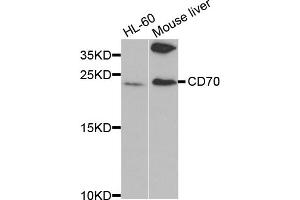Western blot analysis of extracts of various cell lines, using CD70 antibody (ABIN5971064) at 1/1000 dilution. (CD70 Antikörper)