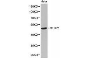 Western Blotting (WB) image for anti-C-terminal Binding Protein 1 (CTBP1) antibody (ABIN1872058) (CTBP1 Antikörper)