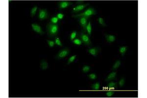 Immunofluorescence of monoclonal antibody to GABPA on HeLa cell. (GABPA Antikörper  (AA 1-100))