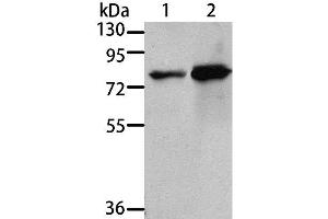 Western Blot analysis of 293T and A431 cell using MSN Polyclonal Antibody at dilution of 1:500 (Moesin Antikörper)