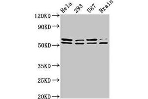 Western Blot Positive WB detected in: Hela whole cell lysate, 293 whole cell lysate, U87 whole cell lysate, Rat brain tissue All lanes: CD3EAP antibody at 3. (CD3EAP Antikörper  (AA 289-404))