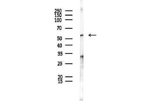 Western blot analysis of lysates from PC12 cells, using DDX6 Antibody at 1/1000 dilution.
