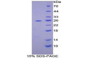 SDS-PAGE (SDS) image for Leucine Aminopeptidase (LAP) (AA 320-519) protein (His tag) (ABIN2125633) (LAP Protein (AA 320-519) (His tag))