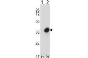 Western Blotting (WB) image for anti-General Transcription Factor IIE, Polypeptide 2 (GTF2E2) antibody (ABIN2997737) (GTF2E2 Antikörper)