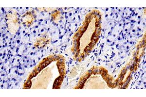 Immunohistochemistry (IHC) image for anti-Keratin 7 (KRT7) (AA 394-457) antibody (ABIN7437020)
