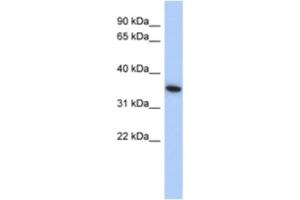 Western Blotting (WB) image for anti-MAX Interactor 1 (MXI1) antibody (ABIN2463882)