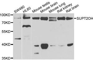 Western blot analysis of extracts of various cell lines, using SUPT20H antibody. (FAM48A/P38IP Antikörper)