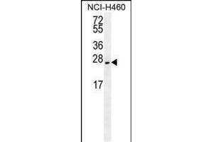 EIF4E2/M antibody (ABIN659116 and ABIN2843758) western blot analysis in NCI- cell line lysates (35 μg/lane). (EIF4E2 Antikörper)