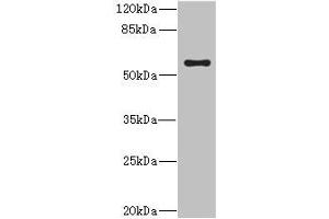 Western blot All lanes: CYP4V2 antibody at 0.