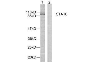 Western blot analysis of extracts from HeLa cells using STAT6 (Ab-641) antibody (E021050). (STAT6 Antikörper)