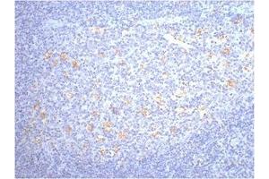 IHC staining of human tonsil tissue, diluted at 1:200. (CD68 Antikörper)