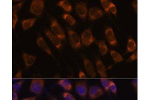 Immunofluorescence analysis of L929 cells using SEC61B Polyclonal Antibody at dilution of 1:100. (SEC61B Antikörper)
