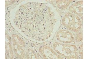 Immunohistochemistry of paraffin-embedded human kidney tissue using ABIN7173675 at dilution of 1:100 (TUBB1 Antikörper  (AA 270-451))