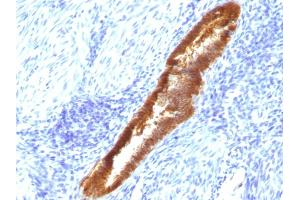 Formalin-fixed, paraffin-embedded human Endometrium stained with ASRGL1 Mouse Monoclonal Antibody (CRASH/1289). (ASRGL1 Antikörper)