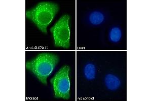 Immunofluorescence (IF) image for anti-Solute Carrier Family 7, (Cationic Amino Acid Transporter, Y+ System) Member 11 (SLC7A11) (Internal Region) antibody (ABIN190899)