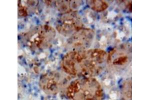 Used in DAB staining on fromalin fixed paraffin-embedded Kidney tissue (IL1RL1 Antikörper  (AA 357-532))