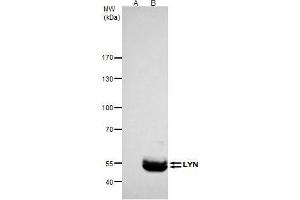 Immunoprecipitation (IP) image for anti-V-Yes-1 Yamaguchi Sarcoma Viral Related Oncogene Homolog (LYN) (Center) antibody (ABIN2854977)