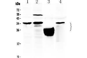 Western blot analysis of TFPI2 using anti- TFPI2 antibody . (TFPI2 Antikörper  (N-Term))
