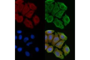 ABIN6257000 and ABIN6274216 staining Hela cells(45 min of heat-shock) by IF/ICC. (RPL10 Antikörper  (N-Term))