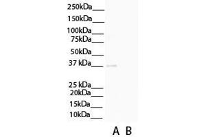 WB Suggested Anti-C1QTNF3 Antibody Titration: 0. (C1QTNF3 Antikörper  (N-Term))