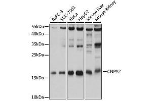 Western blot analysis of extracts of various cell lines, using CNPY2 antibody. (CNPY2/MSAP Antikörper  (AA 1-182))