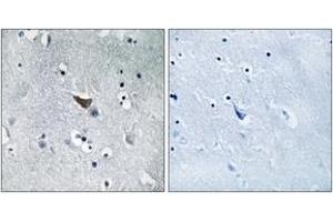Immunohistochemistry analysis of paraffin-embedded human brain tissue, using GluR1 (Ab-849) Antibody. (Glutamate Receptor 1 Antikörper  (AA 816-865))