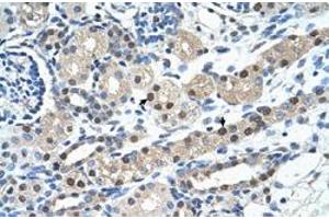 Immunohistochemical staining (Formalin-fixed paraffin-embedded sections) of human kidney with IGSF1 polyclonal antibody  at 4-8 ug/mL working concentration. (IGSF1 Antikörper  (N-Term))