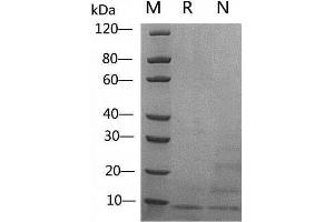 IGF1 Protein (AA 49-118)