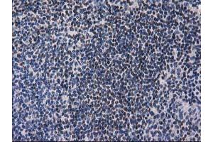 Immunohistochemical staining of paraffin-embedded Human lymph node tissue using anti-ANKRD53 mouse monoclonal antibody. (ANKRD53 Antikörper  (AA 1-300))