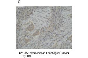 C. (CYP3A5 Antikörper  (C-Term))