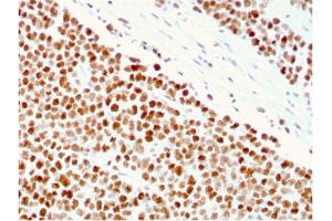 Formalin-fixed, paraffin-embedded human Small Intestine stained with MSH6 Mouse Monoclonal Antibody (MSH6/3086). (MSH6 Antikörper  (AA 374-540))