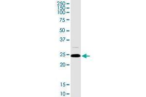 ARHGDIA MaxPab rabbit polyclonal antibody. (ARHGDIA Antikörper  (AA 1-204))