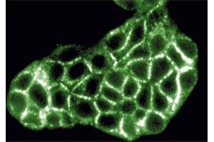 Immunofluorescence (IF) image for anti-Inositol 1,4,5-Trisphosphate Receptor, Type 3 (ITPR3) (AA 22-230) antibody (ABIN967898)