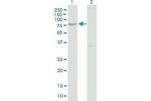 Western Blotting (WB) image for anti-T-Cell, Immune Regulator 1, ATPase, H+ Transporting, Lysosomal V0 Subunit A3 (TCIRG1) (AA 1-614) antibody (ABIN523713)