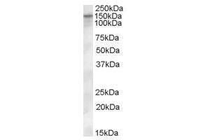 Image no. 1 for anti-Solute Carrier Family 12 (Potassium-Chloride Transporter) Member 4 (SLC12A4) (Internal Region) antibody (ABIN374882) (SLC12A4 Antikörper  (Internal Region))