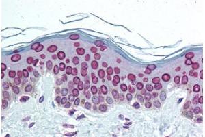 Human Skin (formalin-fixed, paraffin-embedded) stained with LMNA antibody ABIN291872 at 1:50 followed by biotinylated goat anti-rabbit IgG secondary antibody ABIN481713, alkaline phosphatase-streptavidin and chromogen. (Lamin A/C Antikörper  (C-Term))