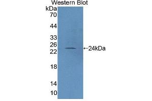 Western blot analysis of the recombinant protein. (PTPRN2 Antikörper  (AA 839-1015))
