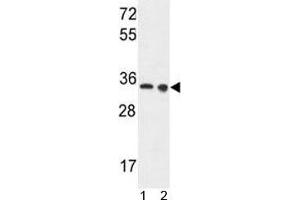 LDHA antibody western blot analysis in 1) Ramos and 2) A375 lysate. (Lactate Dehydrogenase A Antikörper  (AA 154-182))