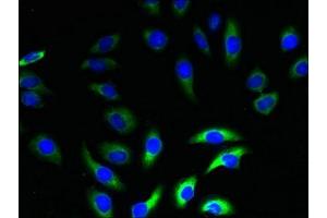 Immunofluorescent analysis of A549 cells using ABIN7161211 at dilution of 1:100 and Alexa Fluor 488-congugated AffiniPure Goat Anti-Rabbit IgG(H+L) (NRSN2 Antikörper  (AA 1-65))