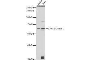 Western Blotting (WB) image for anti-Ribosomal Protein S6 Kinase, 70kDa, Polypeptide 1 (RPS6KB1) (AA 361-525) antibody (ABIN7270029)