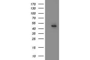 Western Blotting (WB) image for anti-Mitochondrial Methionyl-tRNA Formyltransferase (MTFMT) (AA 175-389) antibody (ABIN1491020) (MTFMT Antikörper  (AA 175-389))