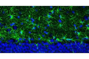 Representative section of formalin fixed, paraffin-embedded rat brain hippocampus region showing staining of GFAP.