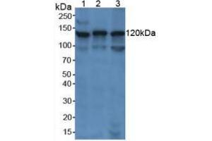 Figure. (PARP1 Antikörper  (AA 661-881))