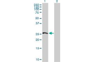 Western Blot analysis of PSMA8 expression in transfected 293T cell line by PSMA8 MaxPab polyclonal antibody. (PSMA8 Antikörper  (AA 1-250))