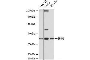 Western blot analysis of extracts of various cell lines using GNB1 Polyclonal Antibody at dilution of 1:1000. (GNB1 Antikörper)