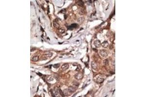 Image no. 2 for anti-HtrA Serine Peptidase 1 (HTRA1) (AA 389-419), (C-Term) antibody (ABIN356844) (HTRA1 Antikörper  (C-Term))