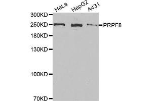 Western Blotting (WB) image for anti-PRP8 Pre-mRNA Processing Factor 8 (PRPF8) antibody (ABIN1877080) (PRPF8 Antikörper)
