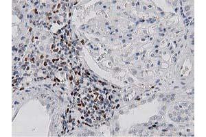Immunohistochemical staining of paraffin-embedded Human Kidney tissue using anti-MSI1 mouse monoclonal antibody. (MSI1 Antikörper)