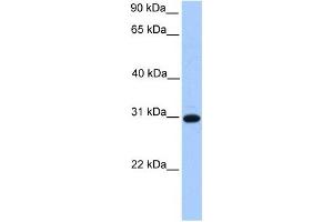 ETFB antibody used at 1 ug/ml to detect target protein. (ETFB Antikörper  (C-Term))